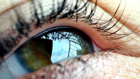 Nahaufnahme eines braungrünen Auges mit langen Wimpern; in der Iris spiegeln sich Himmel und Bäume.
