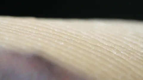Nahaufnahme einer hellen Hautoberfläche mit feinen, parallelen Linien vor dunklem Hintergrund, unten links weich unscharf.